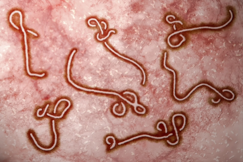 Virus ebola as seen by microscope